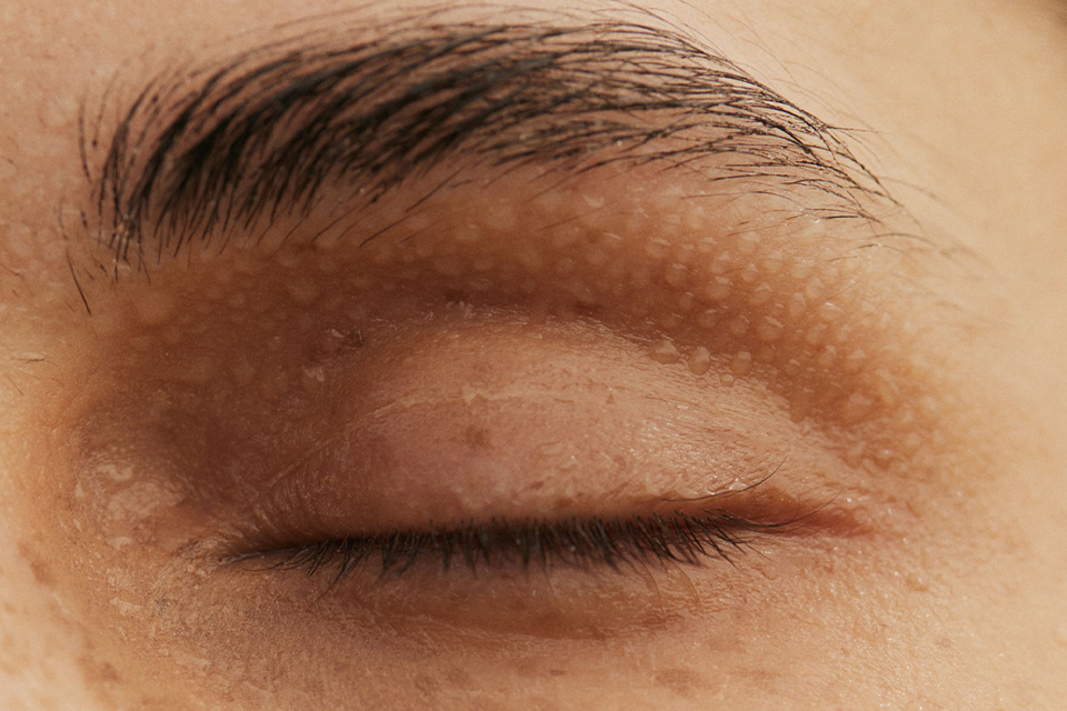 Nahaufnahme eines Gesichts im Augenbereich